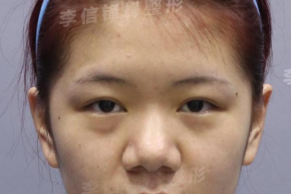 揭密鼻梁凹陷的女人命运：与众不同的生命轨迹