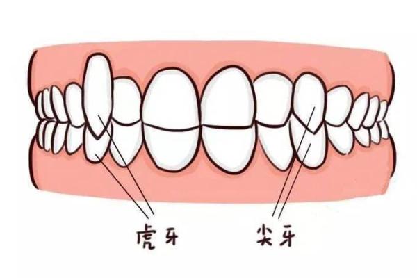 26颗牙齿：揭示命运的秘密与来自口腔的智慧