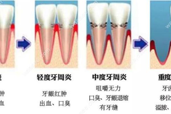 26颗牙齿：揭示命运的秘密与来自口腔的智慧