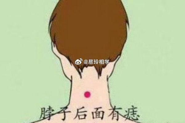 脖子后痣的神秘寓意与命运解析：你的命运藏在哪里？