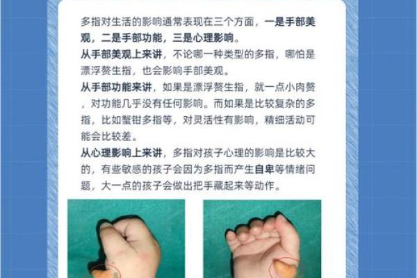 手指畸形与面相分析：解读女命中的不幸与机遇